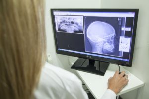doctor diagnosing a traumatic brain injury TBI